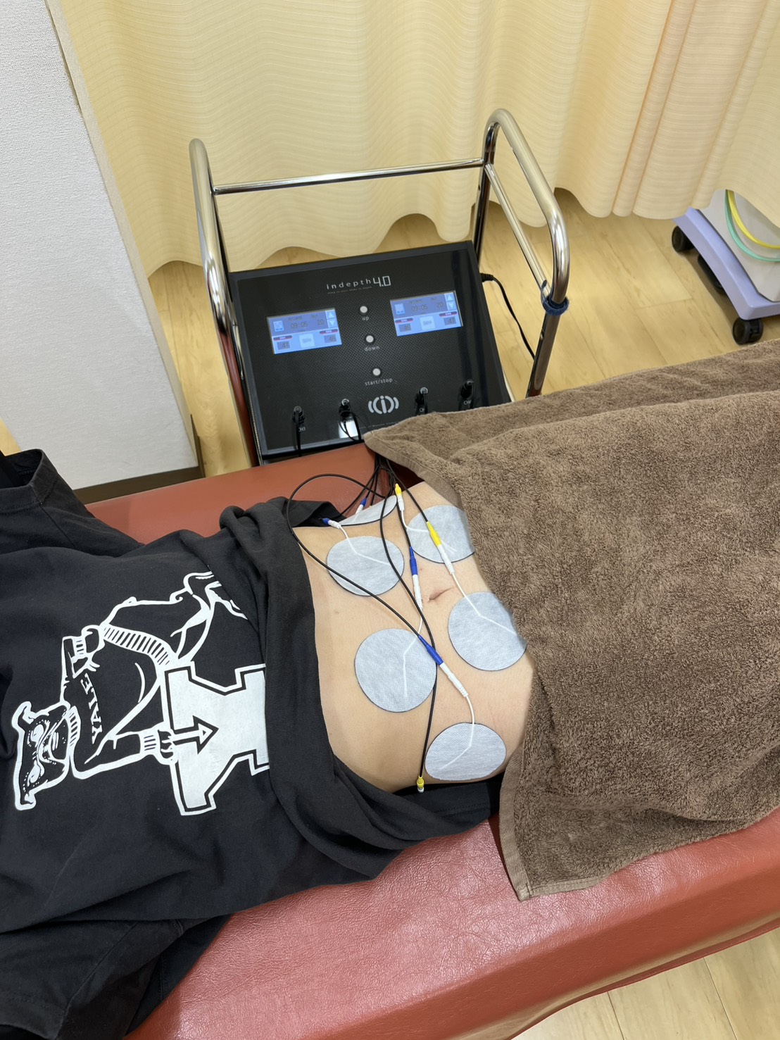 当院のEMS機器「インデプス」について 宇都宮 とば整骨院｜宇都宮市